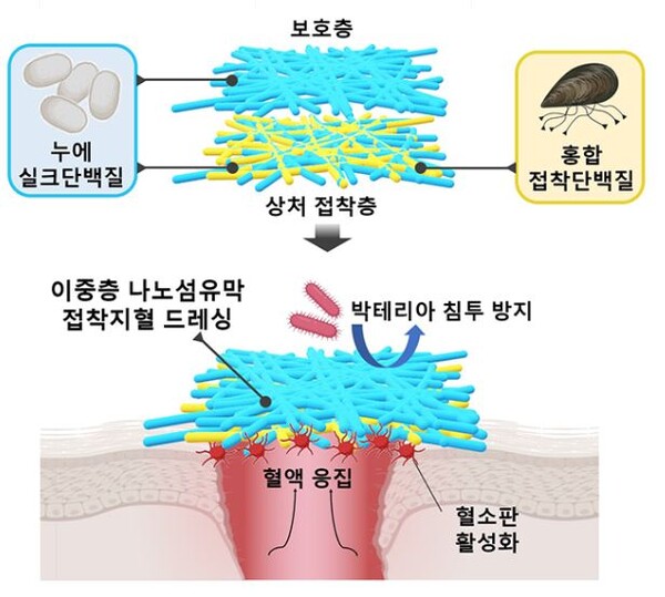 홍합과 누에고치 단백질 사용한 지혈제 개발 연구팀